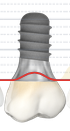 I_IZ_view.png