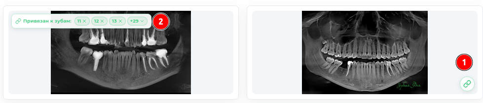 choice_teeth.png