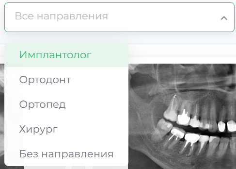 filters_direction.png