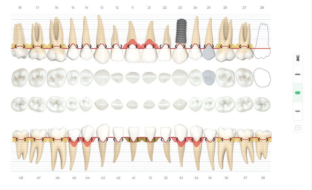 teeth-formula.png