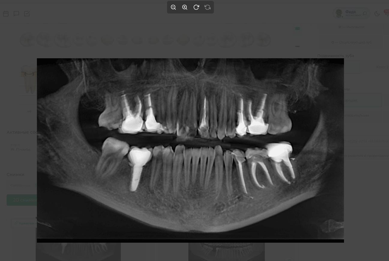 choice_teeth.png